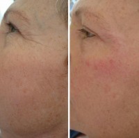 /album/fotogalerie/kh-pred-a-po-3-jpg/